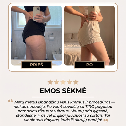 TIRO™ Vakuuminis Anticeliulitinis Masažuoklis
