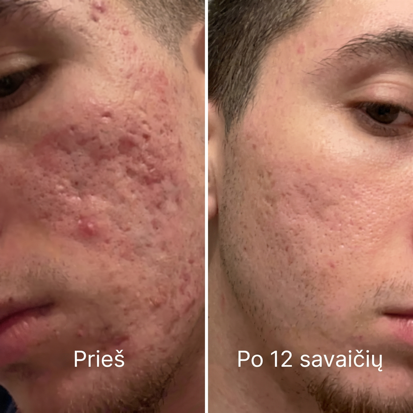 TIRO™ randų po aknės atkuriamasis pieštukas