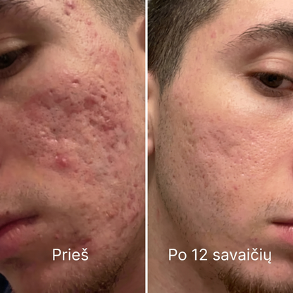 TIRO™ randų po aknės atkuriamasis pieštukas