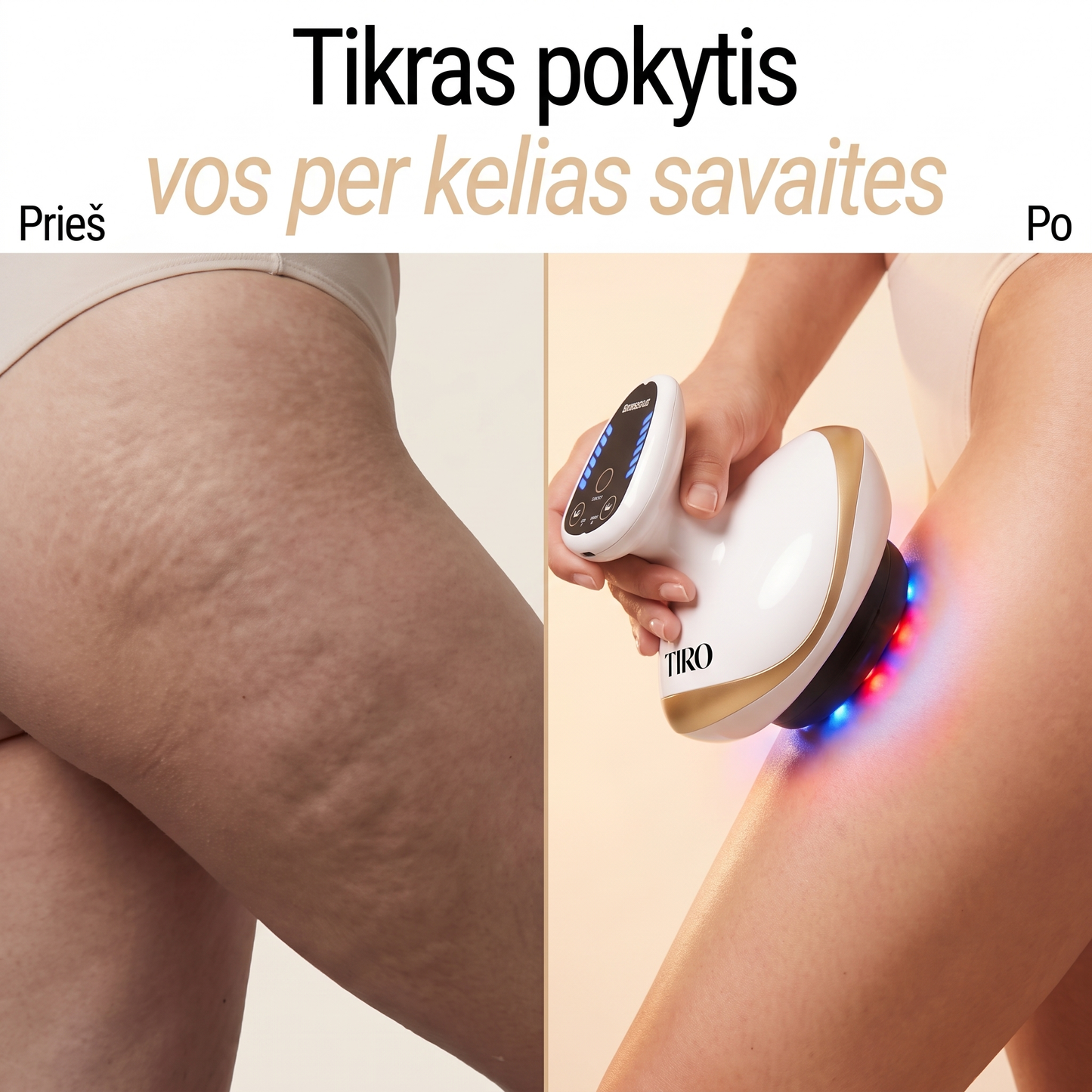TIRO™ Vakuuminis Anticeliulitinis Masažuoklis