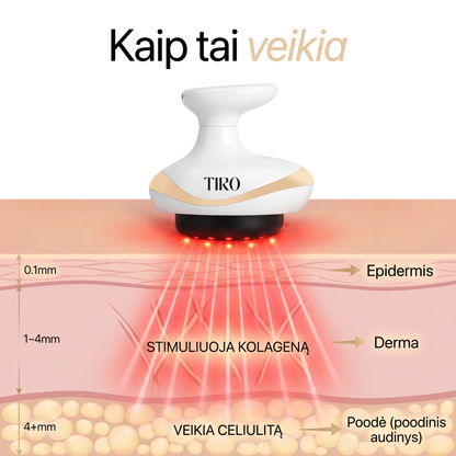TIRO™ Vakuuminis Anticeliulitinis Masažuoklis
